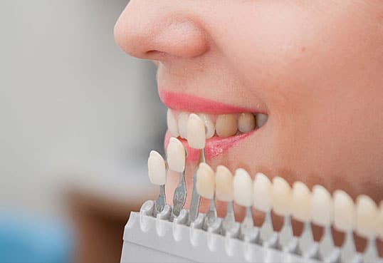 Veneers for your beautiful smile