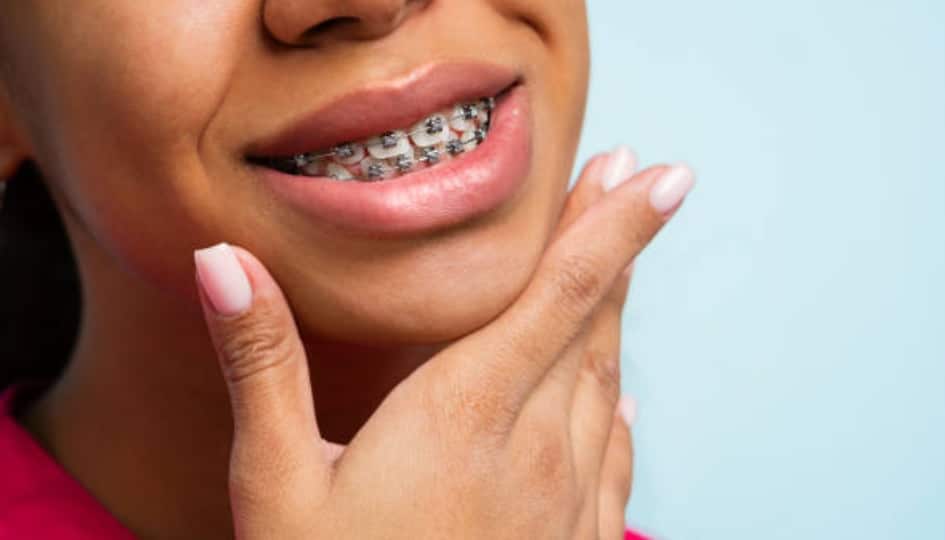Dentist for Traditional Dental Braces