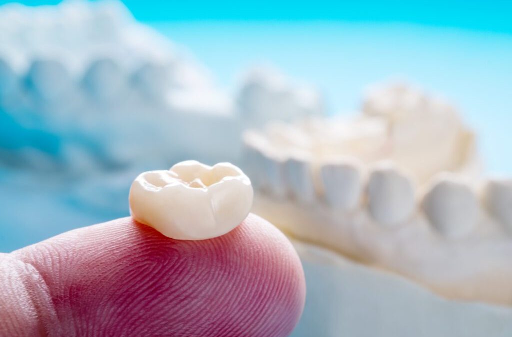 Everything You Need to Know About Dental Crowns: A Comprehensive Guide by Roots & Crown microDENTISTry