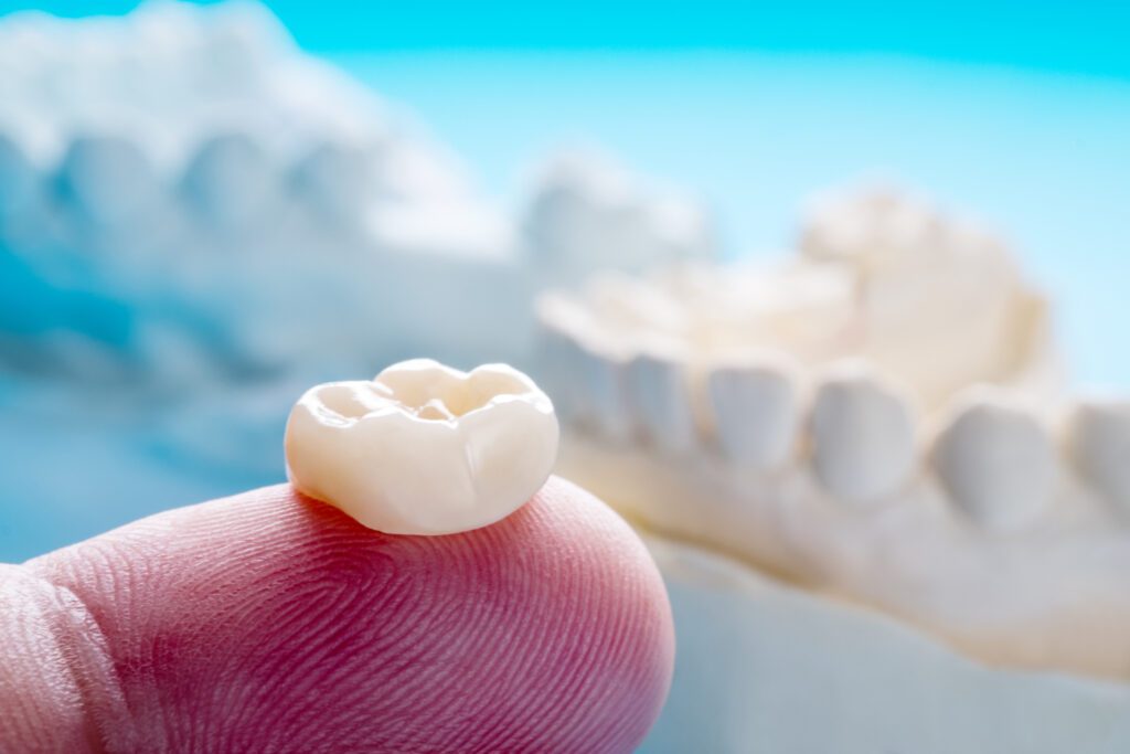 A dental crown on the finger tip