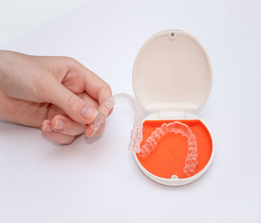 Clear Aligners in Mohali