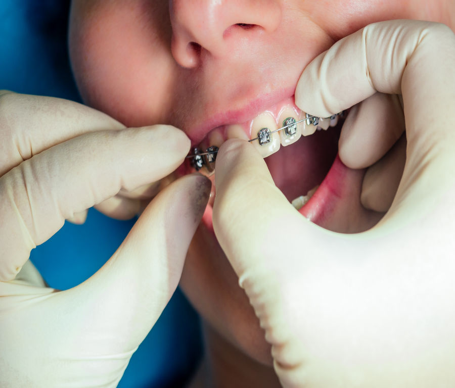 Orthodontists in Mohali and kharar